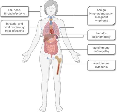 Activated PI3Kδ syndrome – reviewing challenges in diagnosis and treatment